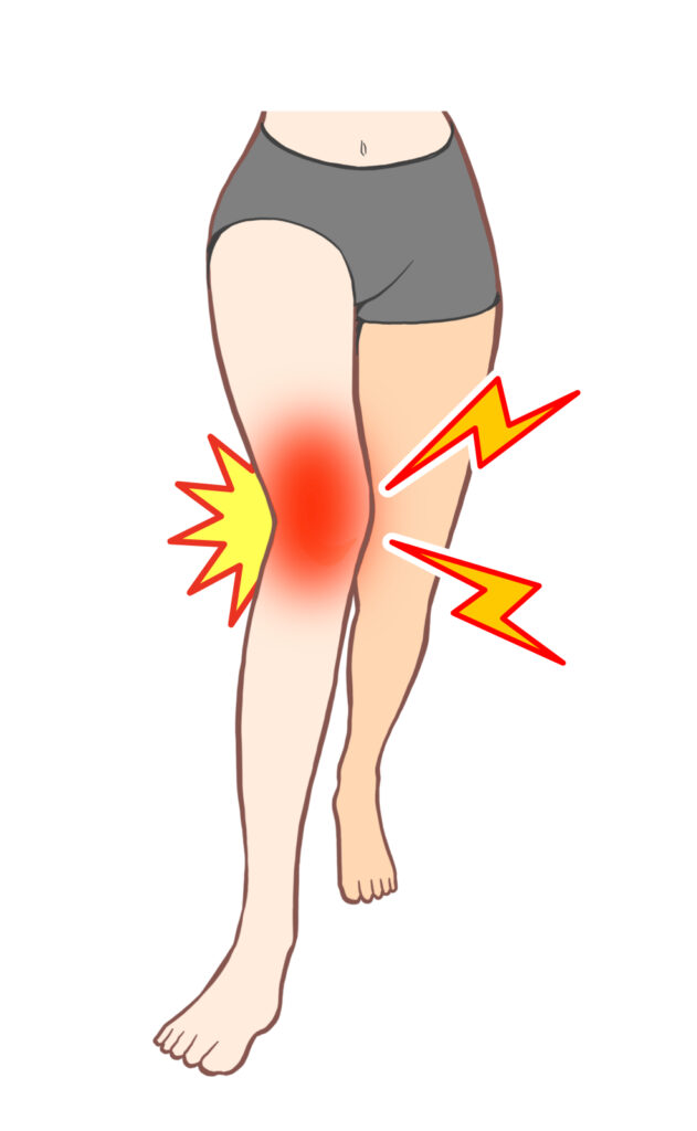 姿勢改善　膝痛改善　内転筋　ハムストリング　Ｏ脚　内股　Ｘ脚　オスグット　変形性膝関節症