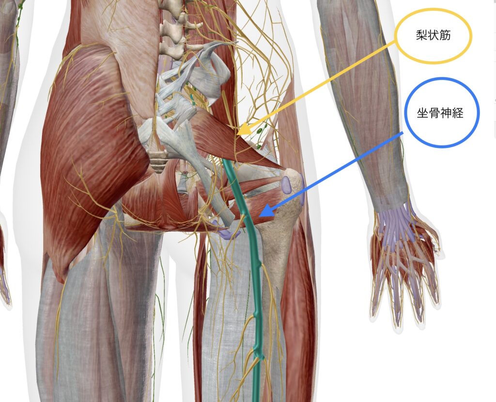 坐骨神経痛　臀部・腿裏の痺れ　反り腰　ヘルニア　脊柱管狭窄症　変形股関節症　梨状筋症候群